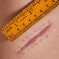 RWP-0281