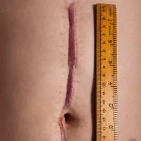 RWP-0263